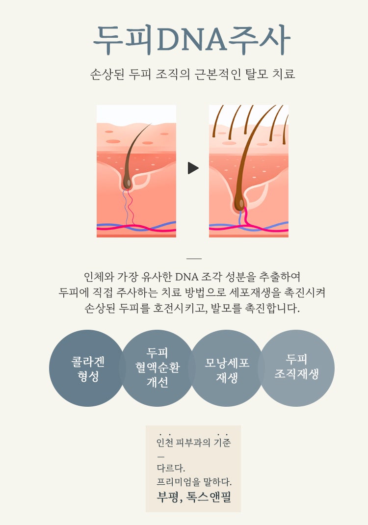 부평탈모치료병원 소아 청소년탈모의