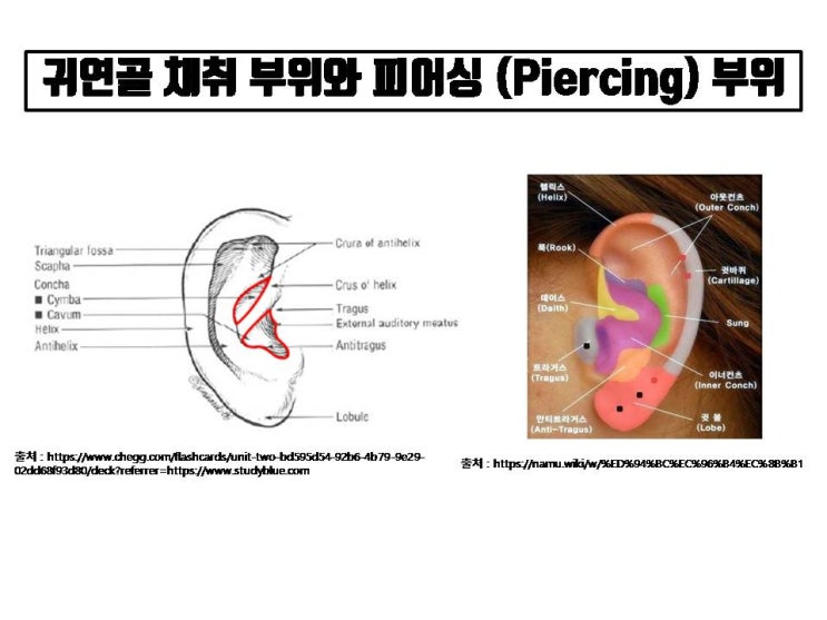  코수술 재료로 귀연골을 채취하고 나면 귀부위에 피어싱을 못하나요?