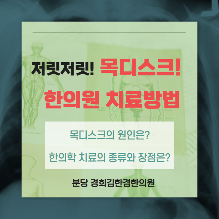  분당목디스크 한의원 치료 - 전문의의 정확한 진단을 통해 팔저림과 두통 등도 개선 가능합니다.