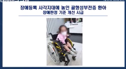골형성부전증 환아, 장애등록 사각지대 골형성부전증 환아, 장애등록 사각지대