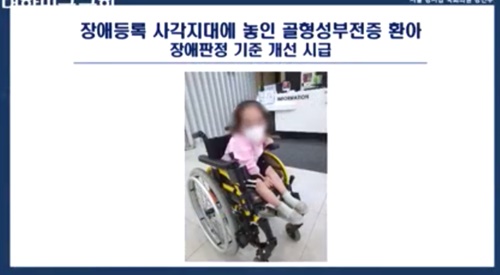 골형성부전증 환아, 장애등록 사각지대