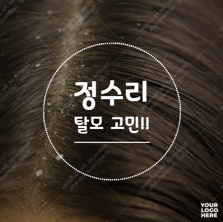  구미 탈모 - 여성 탈모 관리 방법은 어떻게??