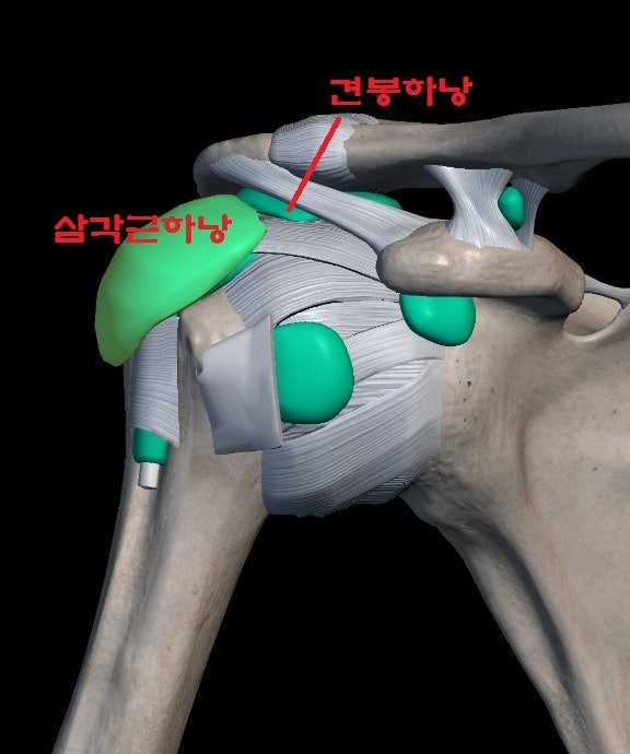 안양한의원 - 오십견 - 동결견(동결어깨) - 유착성관절낭염 : 네이버 블로그