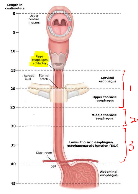 목의 이물감과 이소성 위점막(inlet patch) : 50대 환자 위내시경 소견을 바탕으로 : 네이버 블로그