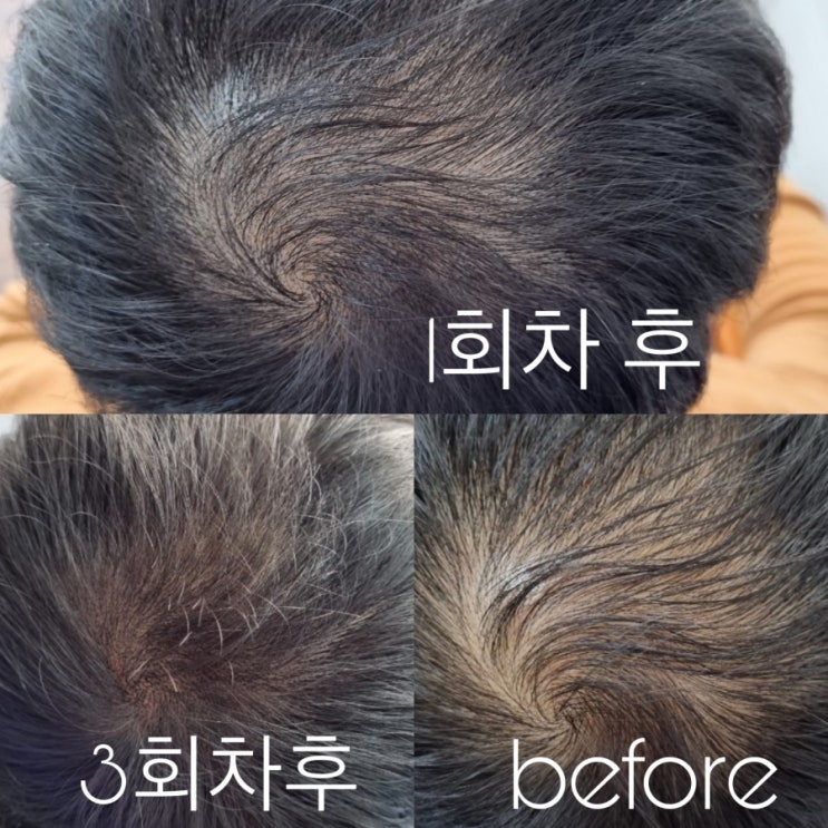  두피문신 제대로 배우세요~