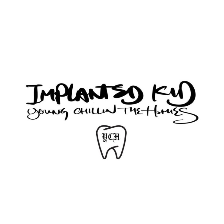 Implanted Kid - 누나 내가 사랑하니까 [노래가사, 듣기, MV]