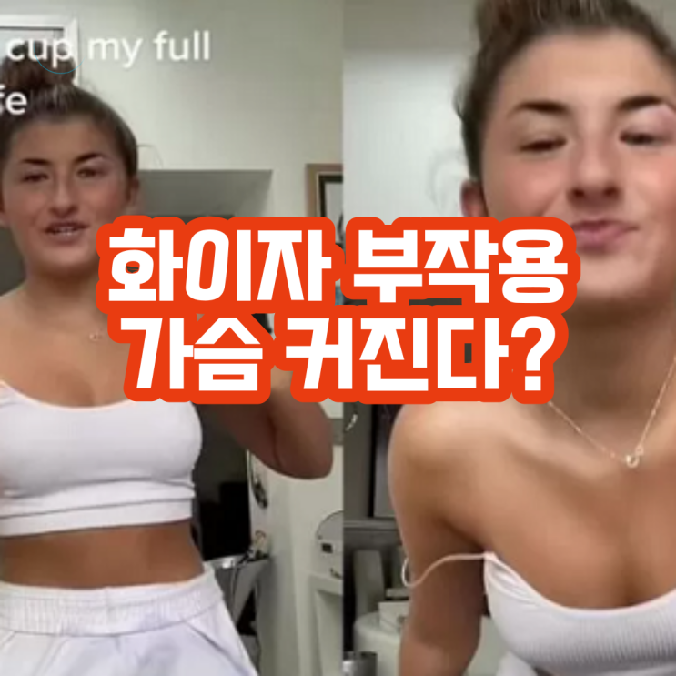 화이자 백신 부작용 가슴 커지는 현상 사실일까?A컵에서 C컵으로 속옷까지 새로 사게 되었다는 소녀의 이야기 화이자 백신 부작용 가슴 커지는 현상 사실일까?A컵에서 C컵으로 속옷까지 새로 사게 되었다는 소녀의 이야기