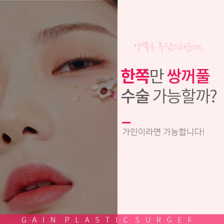  한쪽눈만 쌍수해도 충분한 이유