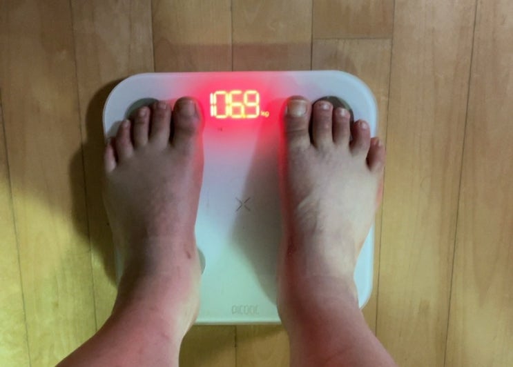  요요없는 다이어트는 없다!! 붓기제거 1일차