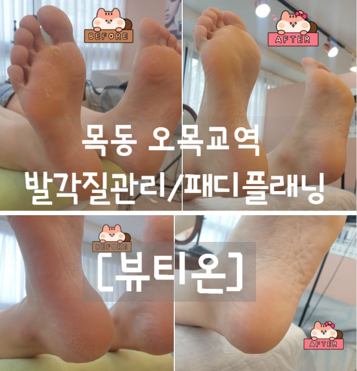  오목교역 패디플래닝 발각질관리 [뷰티온]에서 아기발로 재탄생ㅋ