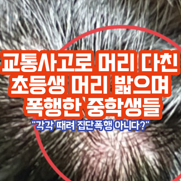 중학생들이 초등생 머리 밟아 구급차로 이송 집단폭행 아니고 시간차 폭행이라고 주장하는 중 중학생들이 초등생 머리 밟아 구급차로 이송 집단폭행 아니고 시간차 폭행이라고 주장하는 중