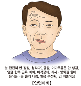 안면신경마비의 예후평가 Measurement of facial nerve function