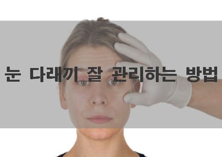  관리가 중요한 눈 다래끼