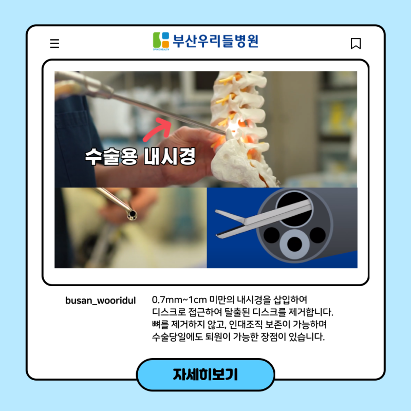 부산허리통증병원 괴정허리통증다리저림 5