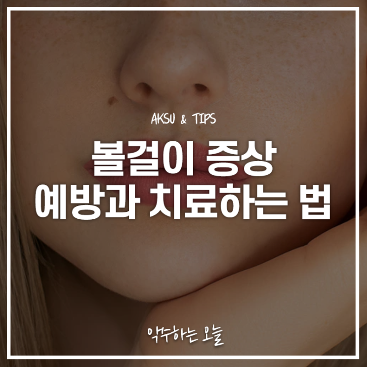  성인도 피할 수 없는 볼걸이 전염될까? 증상 확인 및 예방방법, 치료법 정리