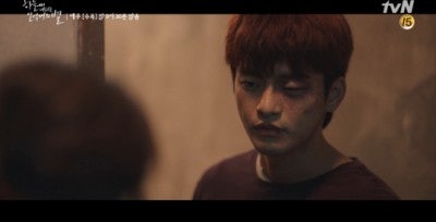 멍드는 꿈 얼굴에 몸에 멍 꿈해몽