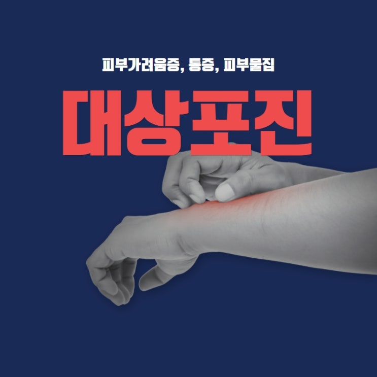  대상포진 초기 증상 및 원인 알아보기