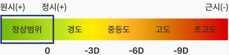  스마일 라식 후기(검사~수술~1주일)-검사받은날-