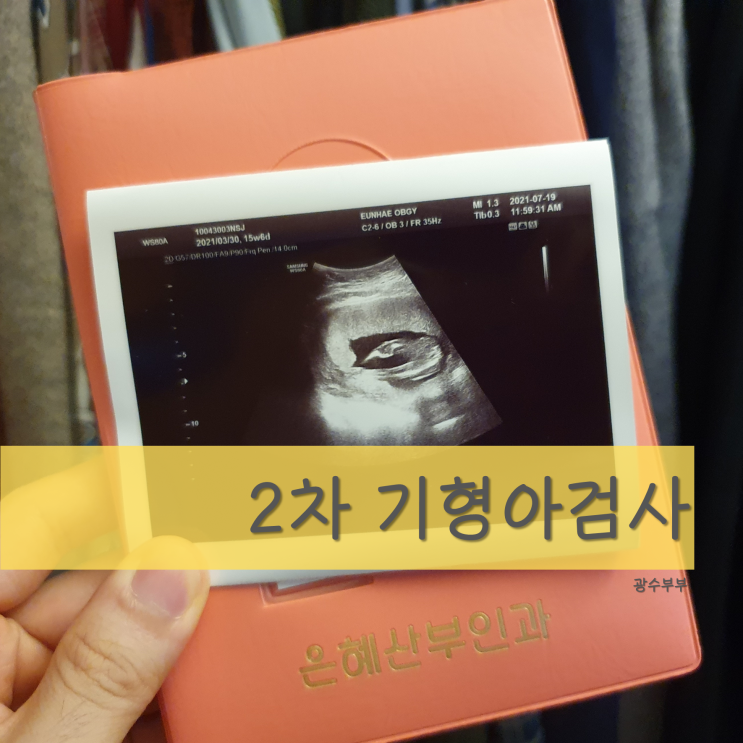  [육아] 임신 16주 : 2차 기형아검사 시기와 결과 : 쿼드검사/양수검사