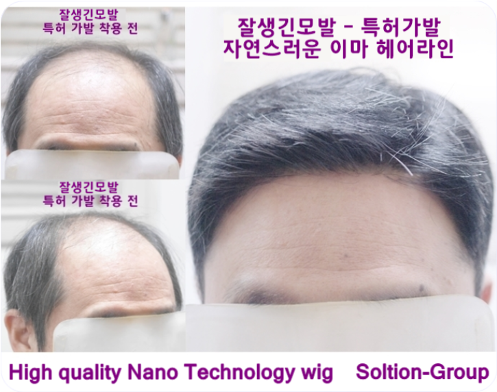  민머리 가발을 남자가 쓴다면 이렇게