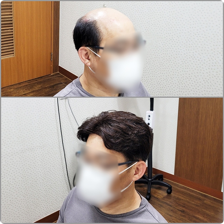  대구가발 울아빤 멋쟁이