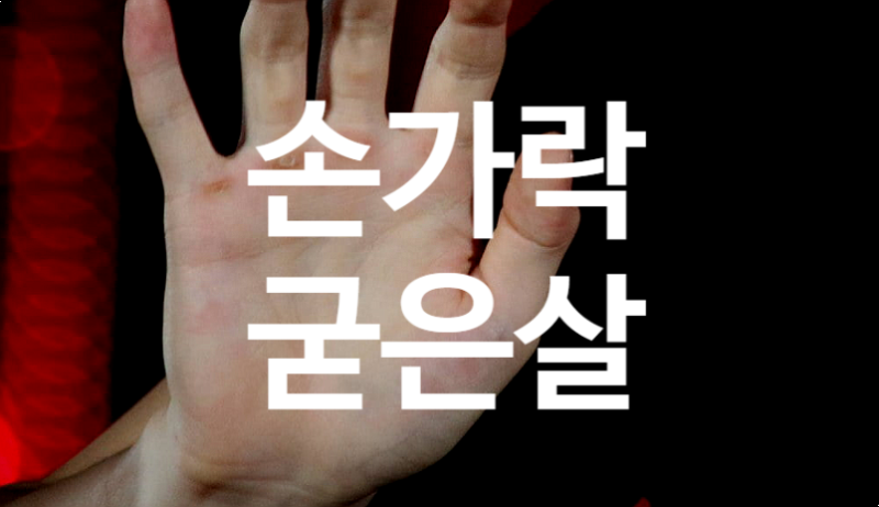 손가락에 굳은살 제거 방법