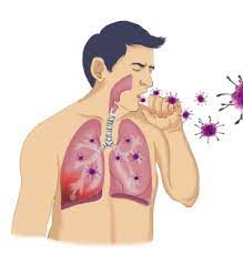 간호학 호흡기계공부 급성호흡부전ARF 호흡곤란증후군ARDS 폐농양 폐암 원인증상 진단치료수술 간호케이스