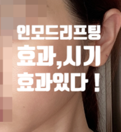  W클리닉 강남점 인모드 더블유의원 인모드 효과 시기 지속기간 탄력 얼굴 각 살리기 !