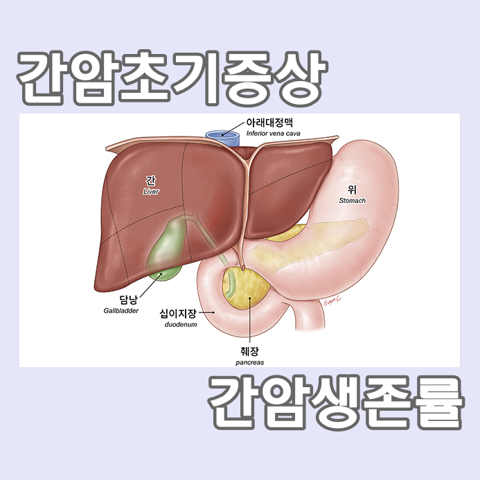  간암초기증상 및 간암생존율