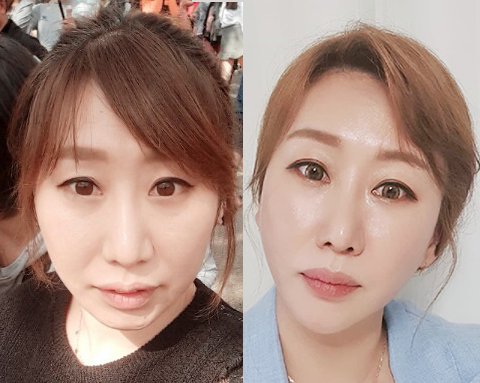  투잡 부천 인셀덤&보타랩