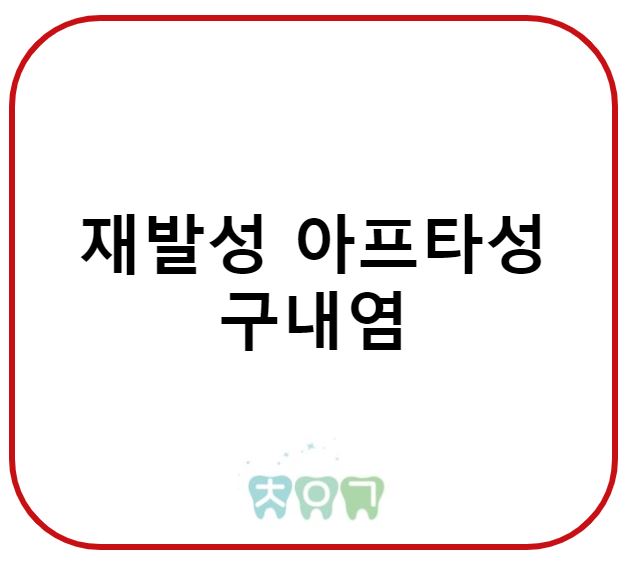  입안에서 자꾸 재발하는 궤양 : 재발성 아프타성 구내염에 대해서
