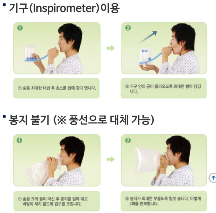  위암수술 후 운동 요령