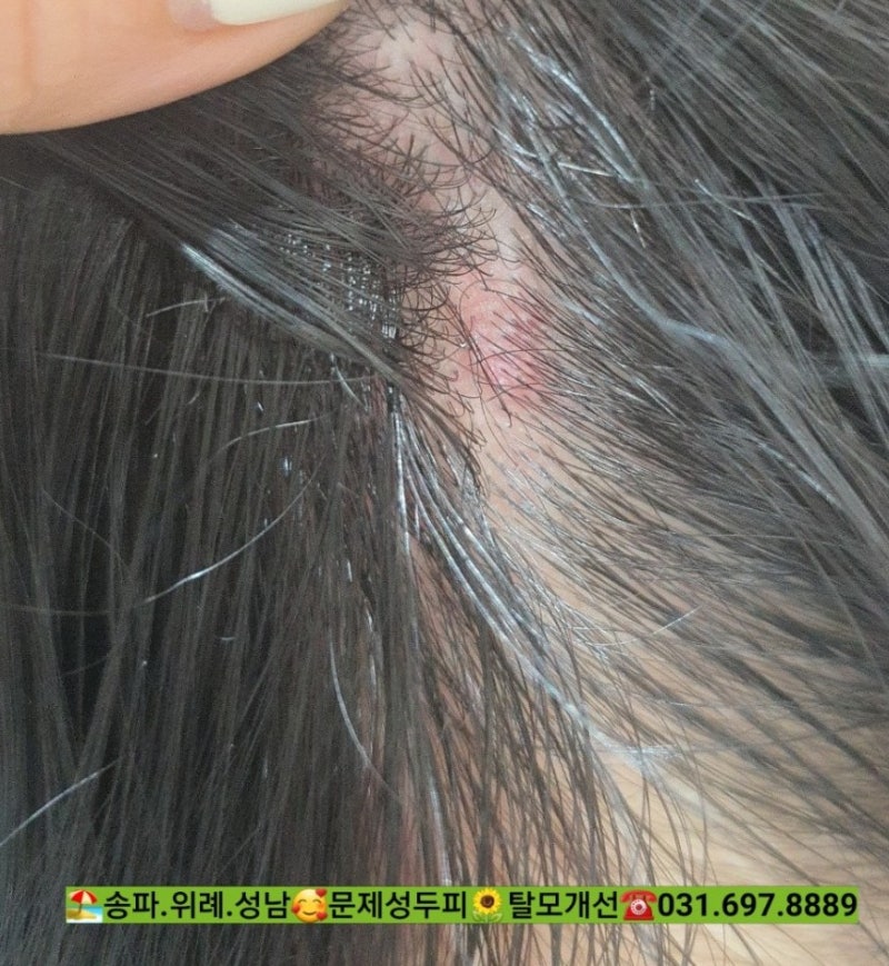 가려운 두피를 위한 각질 제거제.지장미용실에서 두피의 땀냄새가 마음을 상쾌하게 해줍니다. 3