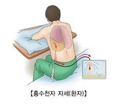 늑막염삼출 원인진단증상 약물치료 흉곽천자술기순서 흉곽배액주의사항 간호학공부