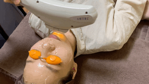  합정피부과 홍대피부과추천 색소침착 레이저토닝&IPL 3회차 후기