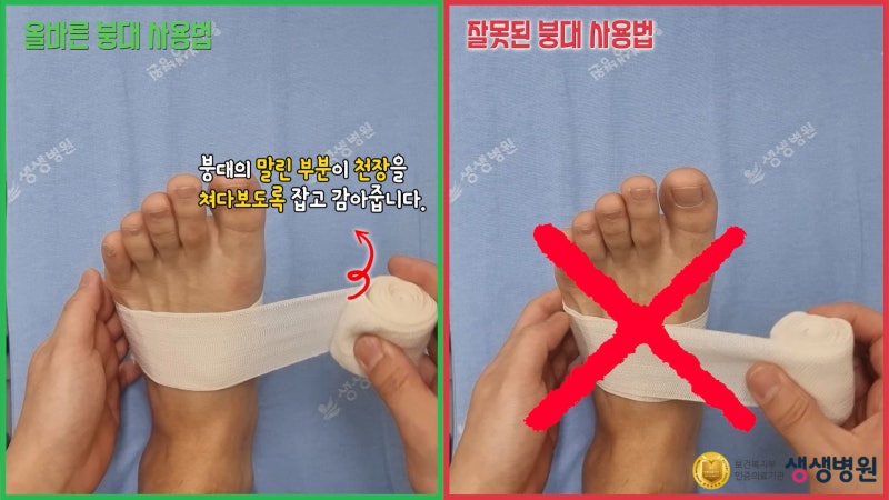 붕대감는법 올바른 붕대 사용법은?!, 삐었을때 응급처치 RICE (손목, 발목, 허리 등) : 네이버 블로그