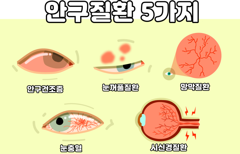 녹내장 치료를 어떻게 할지 고민이라면