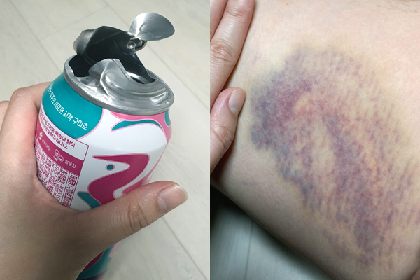 폭발사고로 회수한다던 '구미호 피치에일' 캔맥주 버젓이 유통...대형마트 진열 상품 터져 허벅지 피멍 폭발사고로 회수한다던 '구미호 피치에일' 캔맥주 버젓이 유통...대형마트 진열 상품 터져 허벅지 피멍