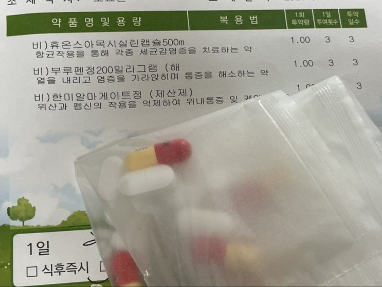  [교정일기] 스크류 4개 심을 마음의 준비.. 15/60