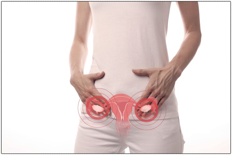  자궁근종 수술비용보다 놓치지 말아야 할 '이것'?