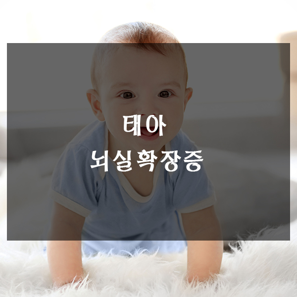  태아 뇌실확장증 알아보기