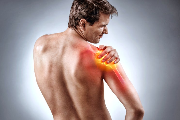 어깨 힘줄 염증, 통증 방치하다 수술까지 받아야 한다?