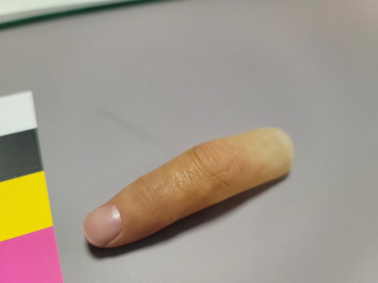  맞춤형 실리콘 손가락 의지 만들고 사용 중 AS도 가능, 오래 쓰세요!