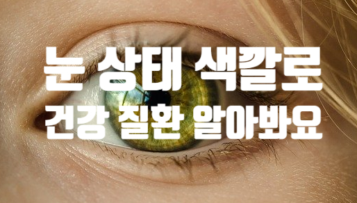  눈 색깔 상태로 보는 건강 질환 (ft. 붉은 노란 검붉은 점 누런 흰자 흰 테두리)