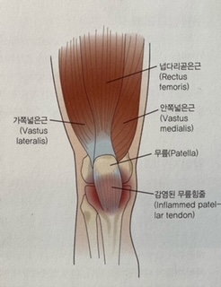 [이수역 필라테스] 무릎통증 원인은? 움직임 결손으로 인한 무릎 손상들