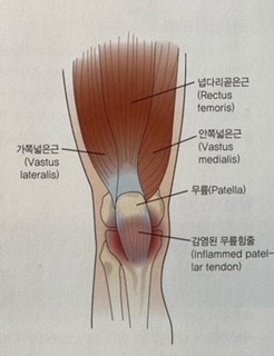  [이수역 필라테스] 무릎통증 원인은? 움직임 결손으로 인한 무릎 손상들