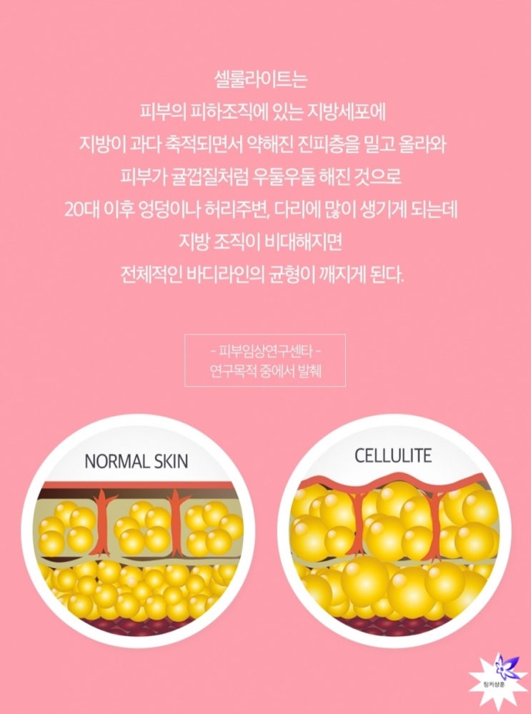  바르면 피부 발열로 내부지방을 태우고 축적된 지방을 골고루 퍼뜨린다. 씨엘라이트 당당크림.