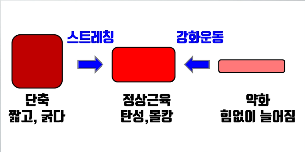 뮤잉운동 부작용 생기는 이유와 그 예방법은? #뮤잉 #뮤잉운동 #하드뮤잉 : 네이버 블로그