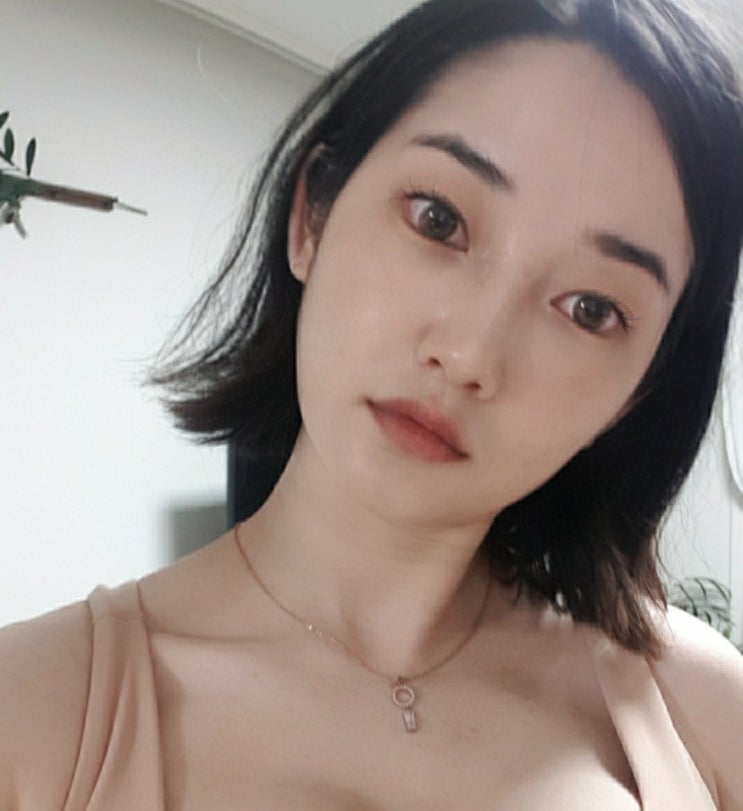  홍대 인모드 비용 & 1회차 효과 전후 비교