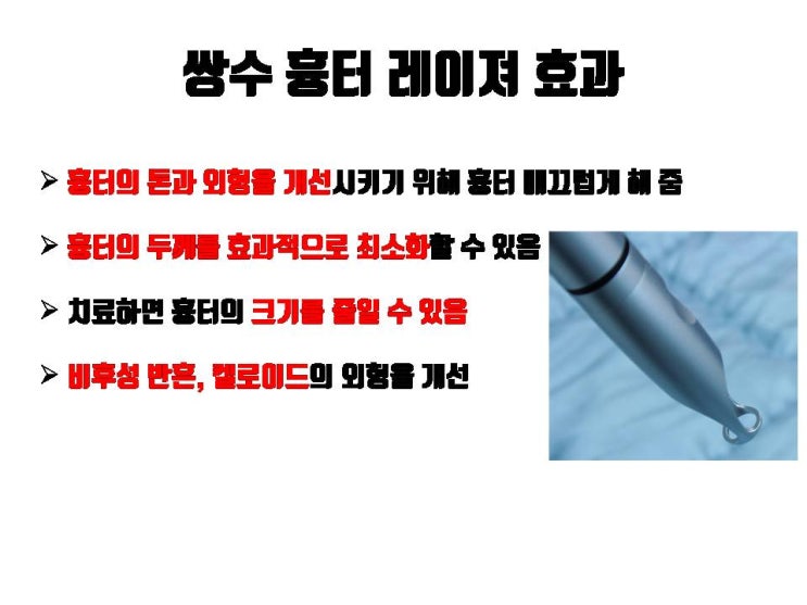  쌍꺼풀 수술 후 절개흉터 굳이 레이저 치료 안 해도 될 것 같아요. 쌍꺼풀 절개 흉터는 시간이 지나면 어차피 좋아지니까요.